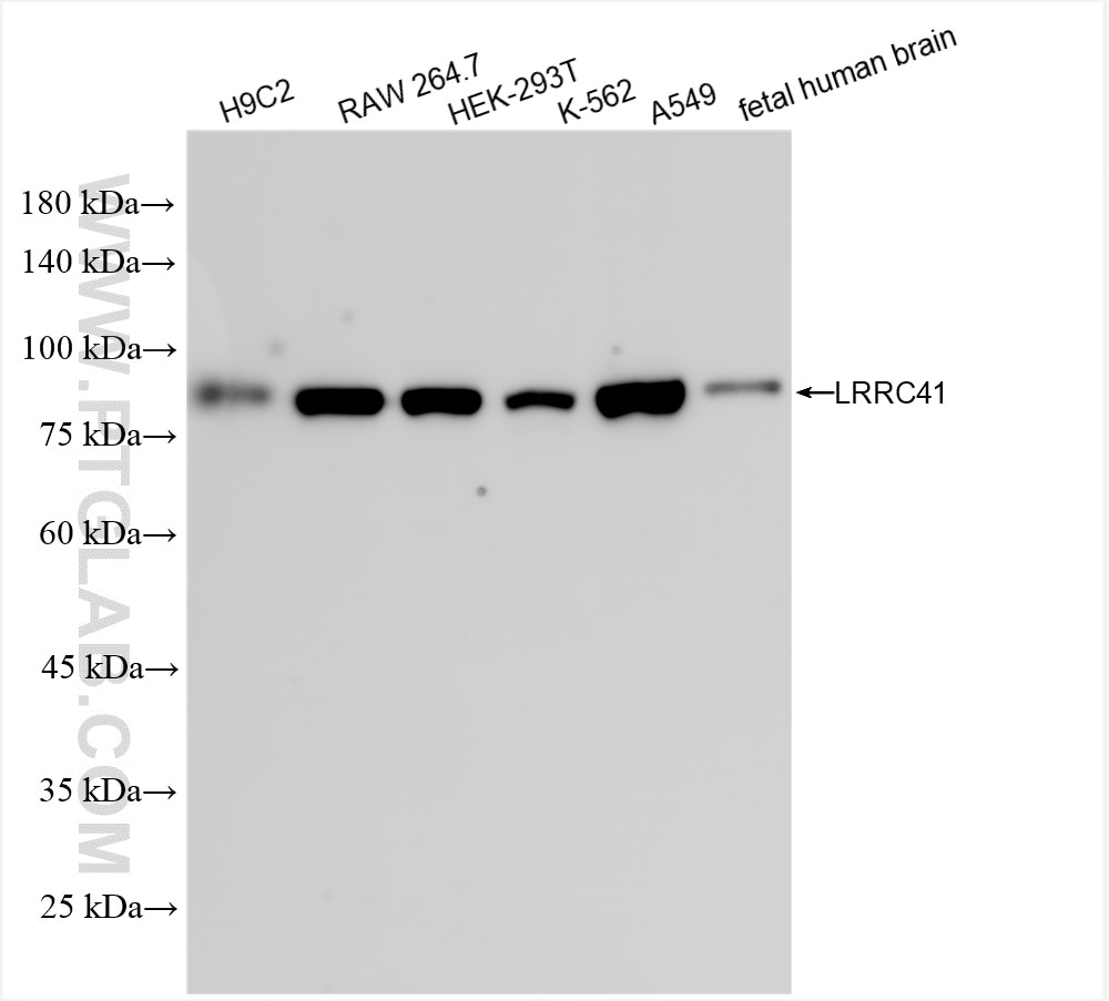 Western Blot (WB) analysis of various lysates using LRRC41 Recombinant antibody (85012-4-RR)