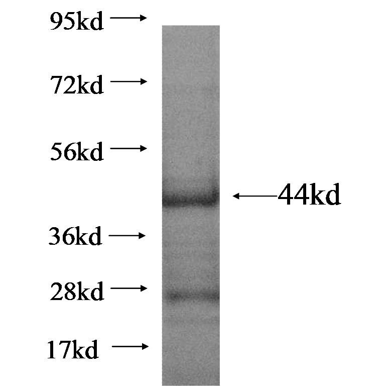 LRRC41 fusion protein Ag17025 SDS-PAGE