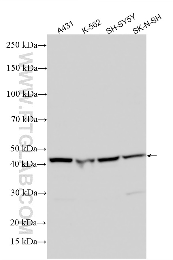 WB analysis using 26348-1-AP (same clone as 26348-1-PBS) Western Blot (WB) analysis of various lysates using LRRC42 Polyclonal antibody (26348-1-AP)