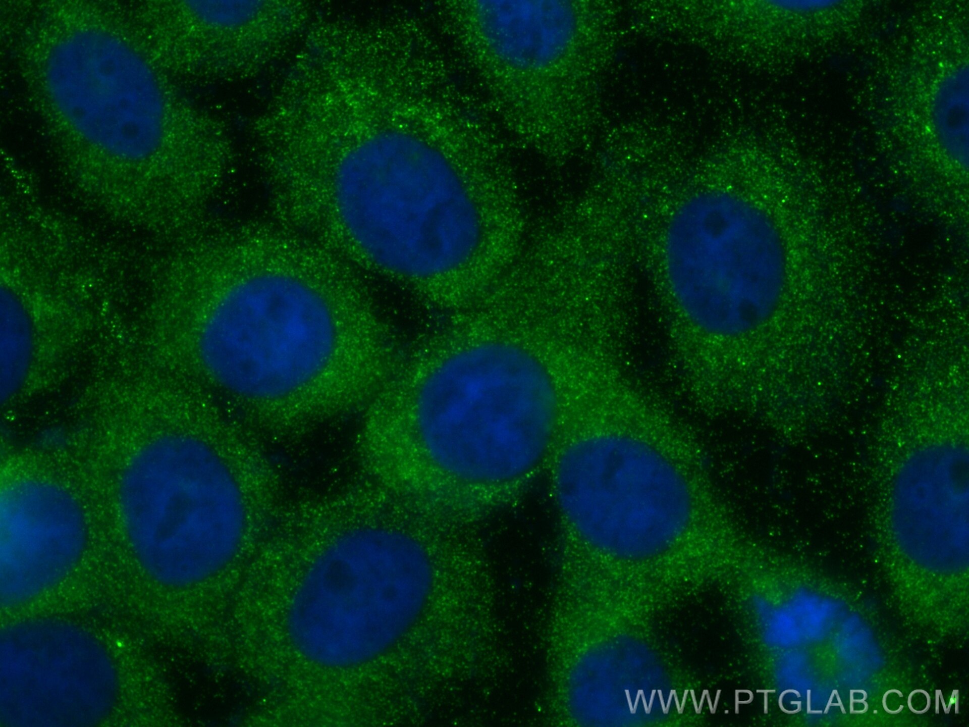 Immunofluorescence (IF) / fluorescent staining of A431 cells using LRRC45 Polyclonal antibody (32111-1-AP)