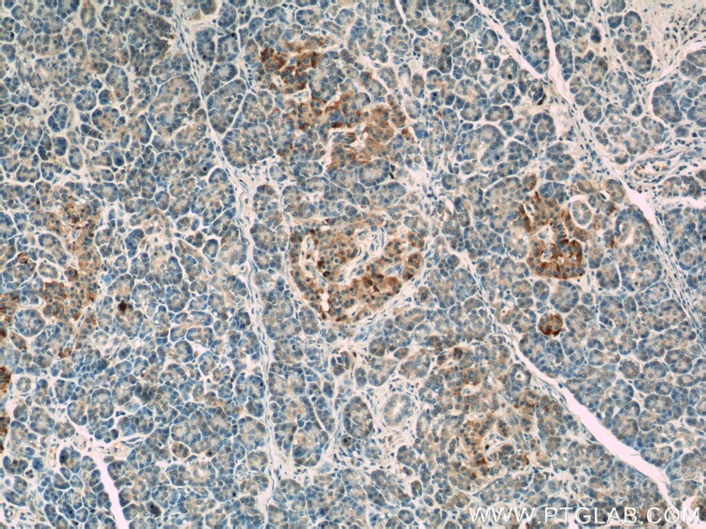 Immunohistochemistry (IHC) staining of human pancreas tissue using LRRC47 Polyclonal antibody (23217-1-AP)