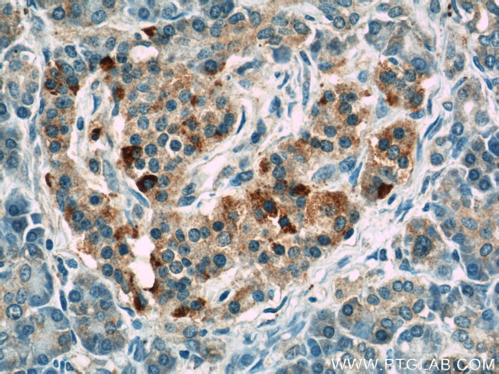 Immunohistochemistry (IHC) staining of human pancreas tissue using LRRC47 Polyclonal antibody (23217-1-AP)