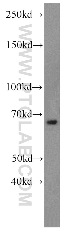 Western Blot (WB) analysis of mouse liver tissue using LRRC47 Polyclonal antibody (23217-1-AP)