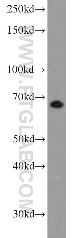 WB analysis of Neuro-2a using 23217-1-AP