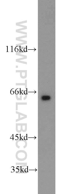 Western Blot (WB) analysis of rat liver tissue using LRRC47 Polyclonal antibody (23217-1-AP)