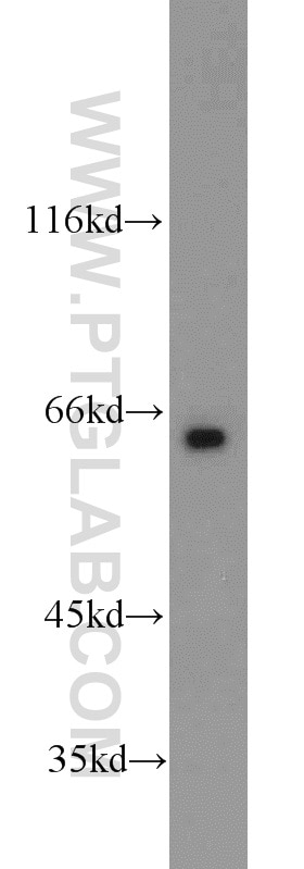 WB analysis of rat liver using 23217-1-AP