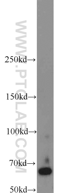 Western Blot (WB) analysis of Neuro-2a cells using LRRC47 Polyclonal antibody (23217-1-AP)