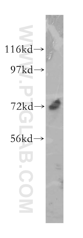 Western Blot (WB) analysis of Y79 cells using LRRC4C Polyclonal antibody (13845-1-AP)