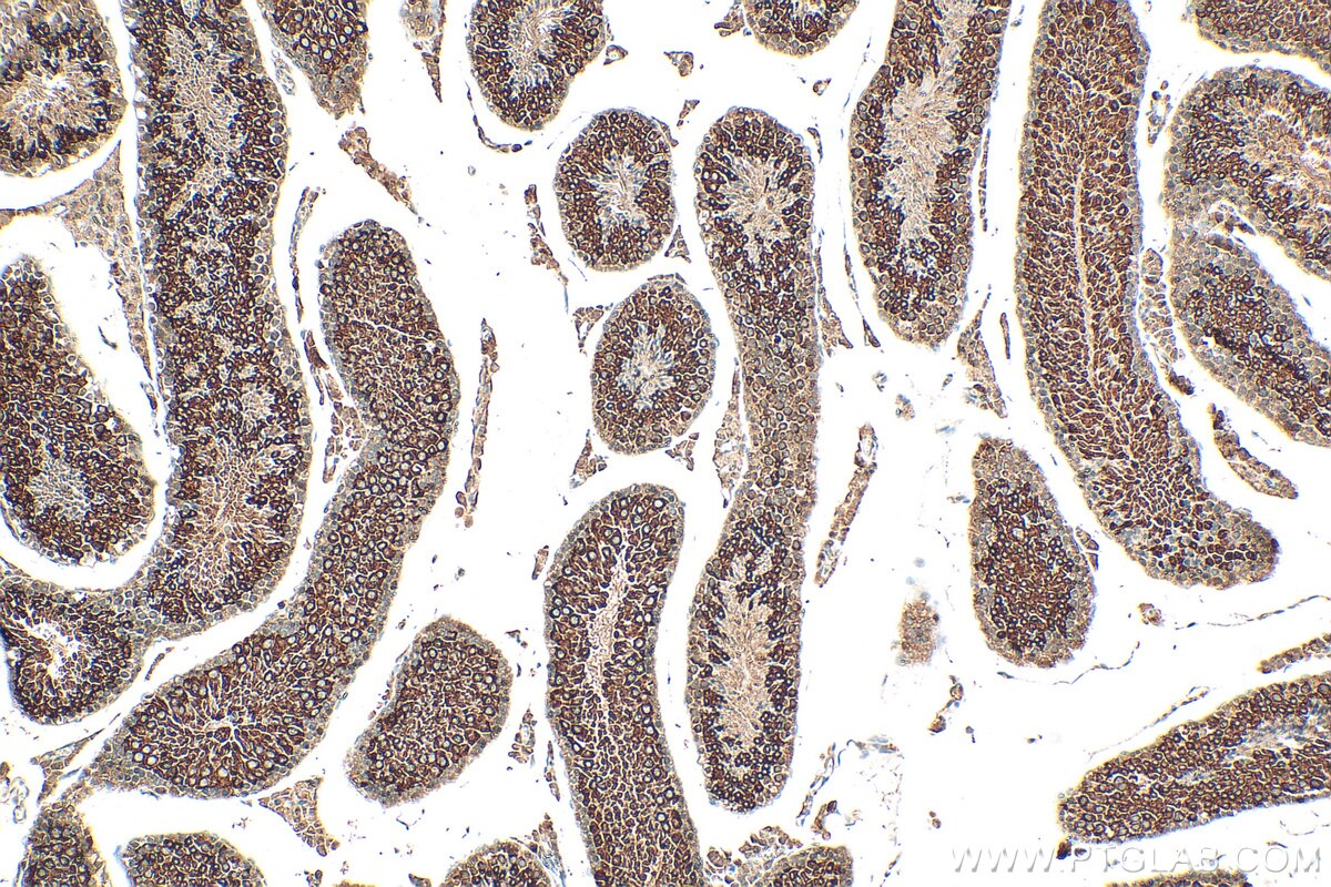 IHC staining of mouse testis using 30156-1-AP