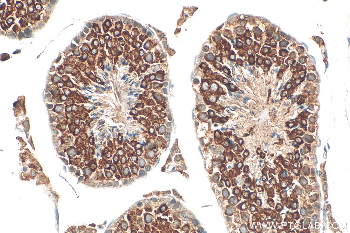 Immunohistochemistry (IHC) staining of mouse testis tissue using LRRC50 Polyclonal antibody (30156-1-AP)