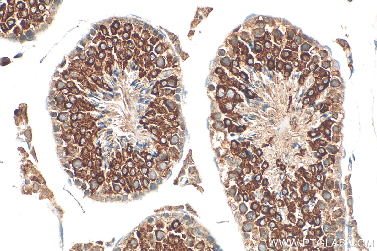 IHC staining of mouse testis using 30156-1-AP