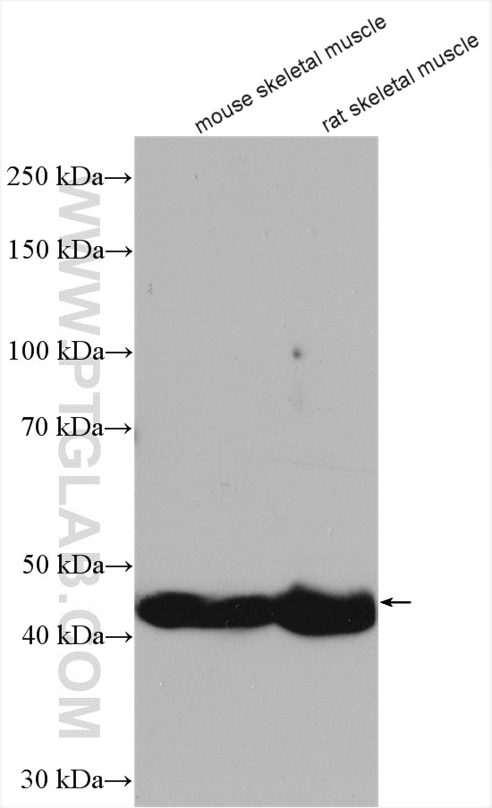 Western Blot (WB) analysis of various lysates using LRRC52 Polyclonal antibody (25584-1-AP)