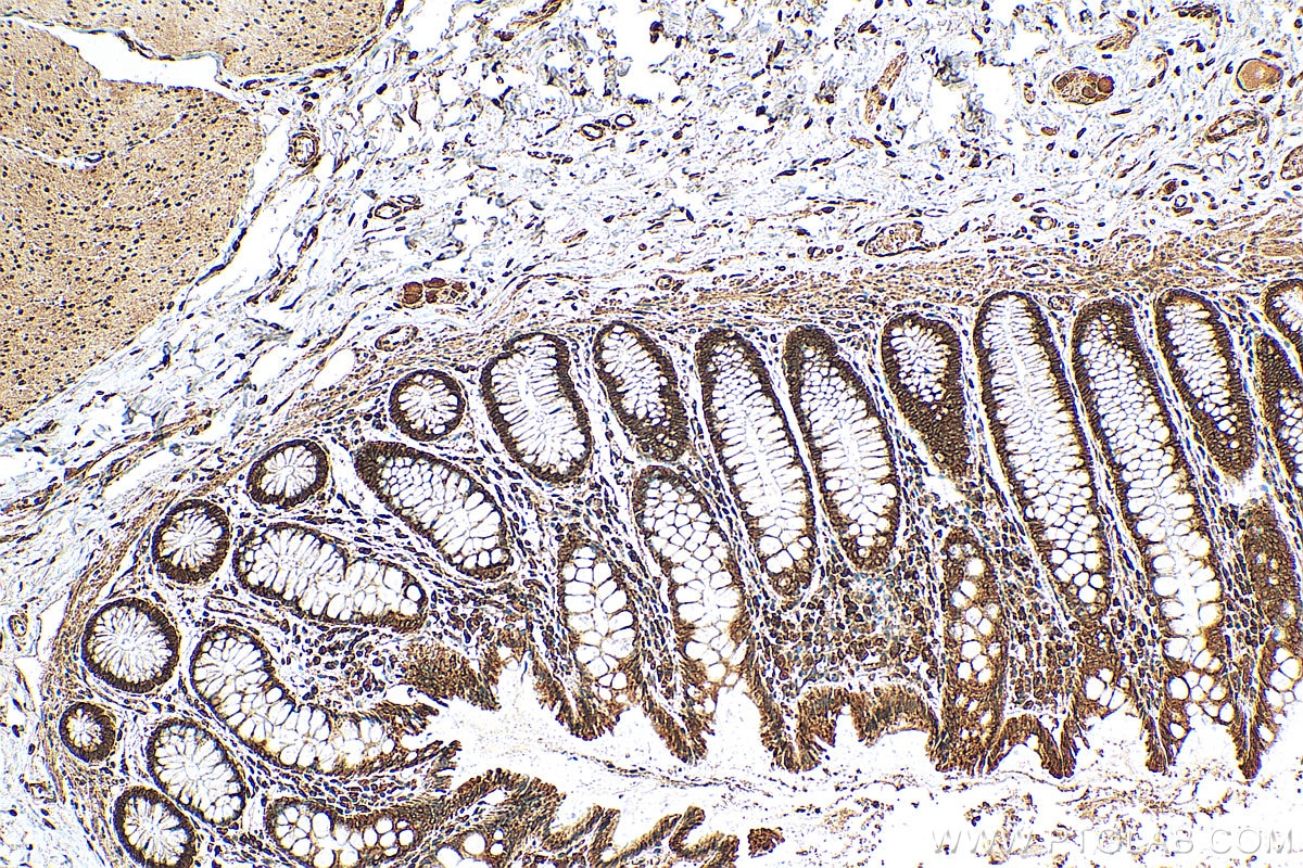 Immunohistochemistry (IHC) staining of human colon tissue using LRRC59 Polyclonal antibody (27208-1-AP)