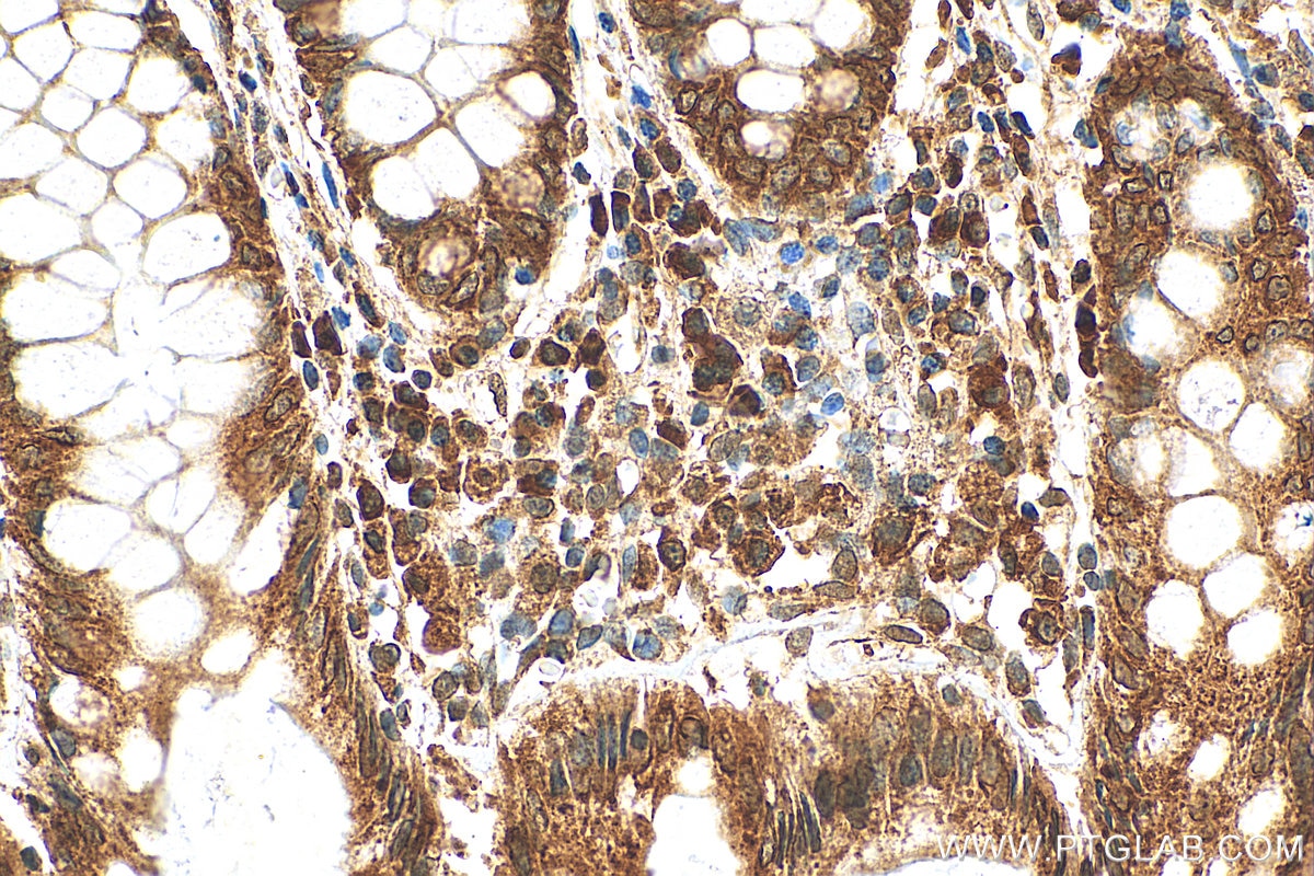 Immunohistochemistry (IHC) staining of human colon tissue using LRRC59 Polyclonal antibody (27208-1-AP)
