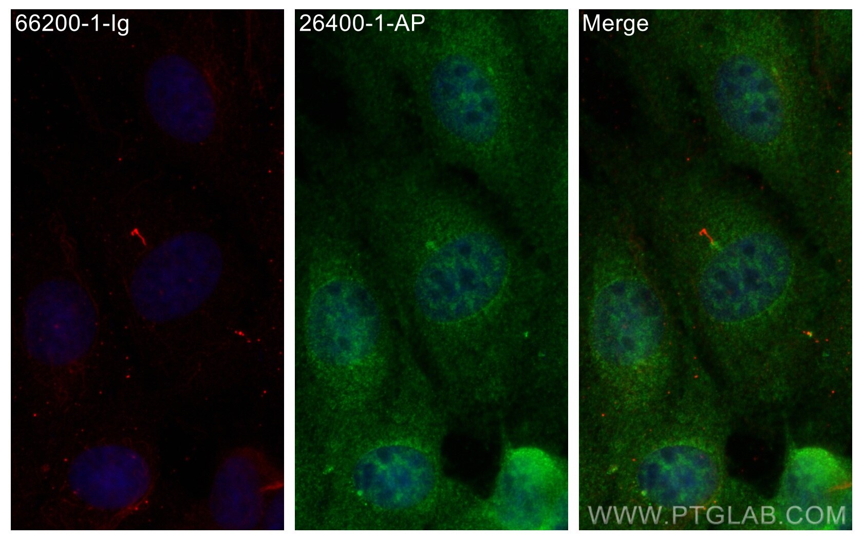 Immunofluorescence (IF) / fluorescent staining of MDCK cells using LRRC6 Polyclonal antibody (26400-1-AP)