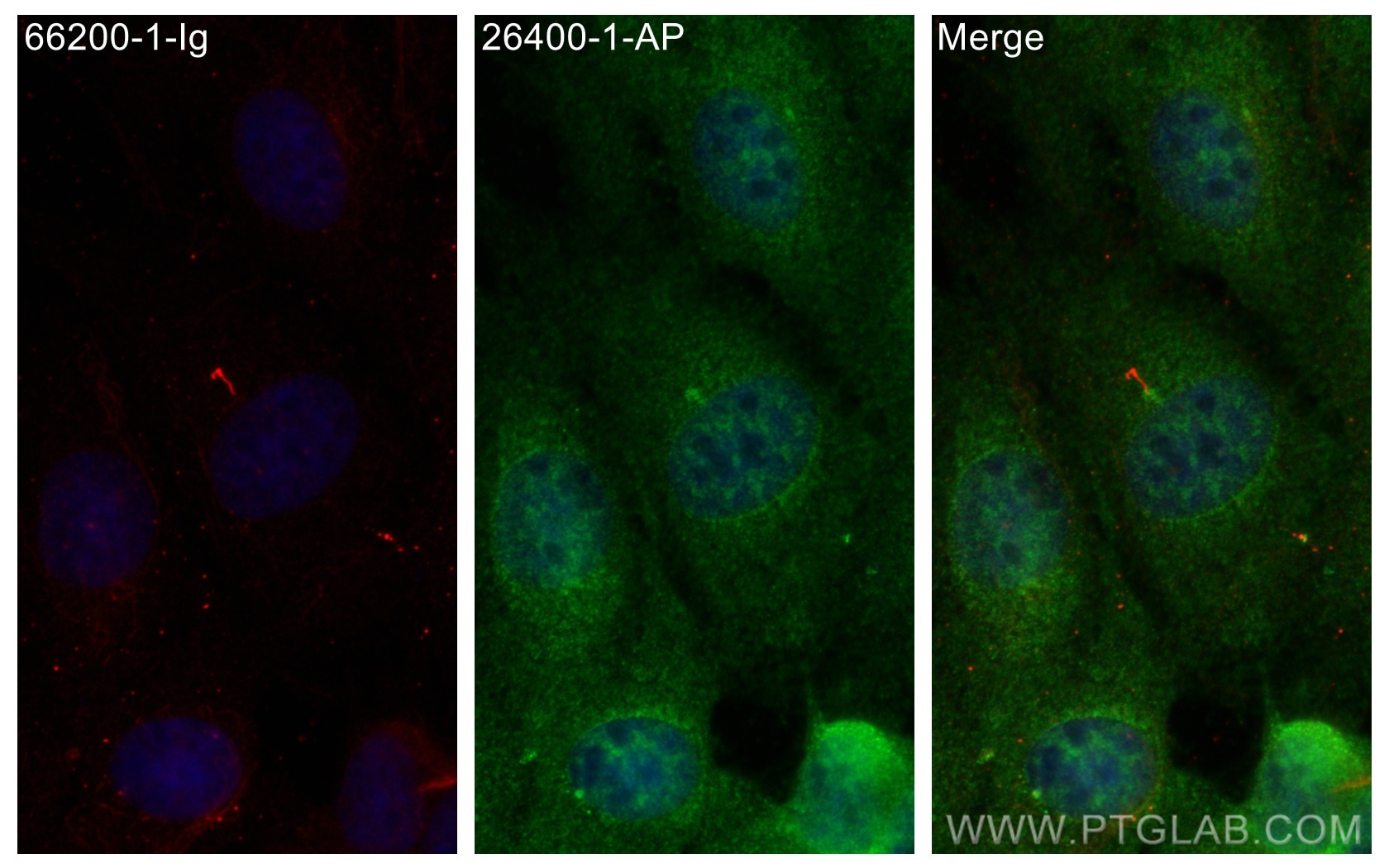 Immunofluorescence (IF) / fluorescent staining of MDCK cells using LRRC6 Polyclonal antibody (26400-1-AP)