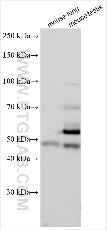 Western Blot (WB) analysis of various lysates using LRRC6 Polyclonal antibody (26400-1-AP)
