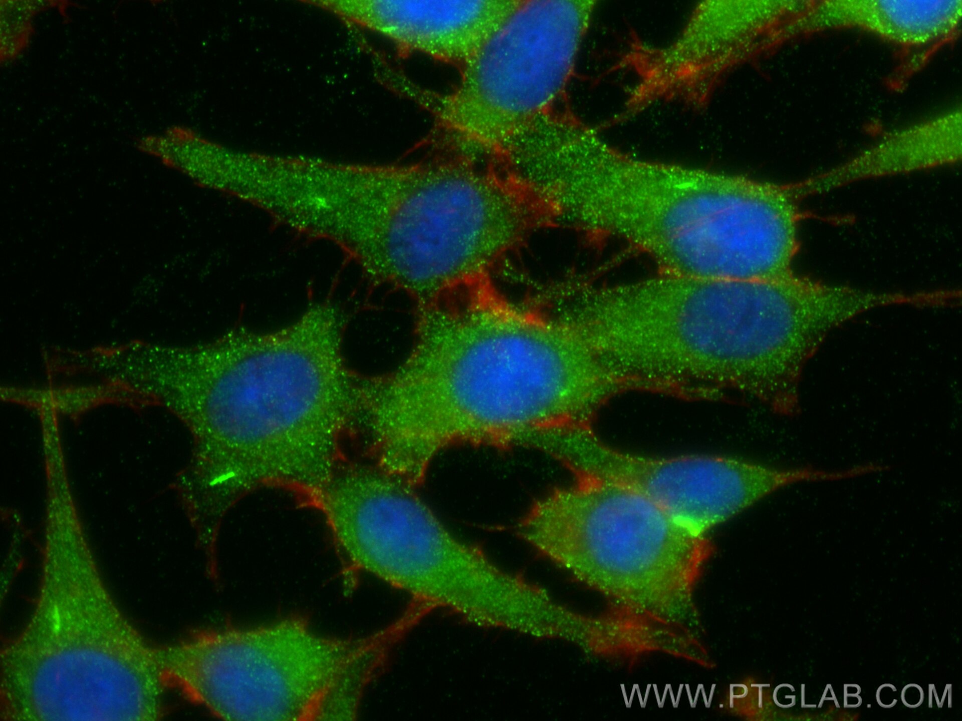 Immunofluorescence (IF) / fluorescent staining of C6 cells using LRRC7 Polyclonal antibody (31040-1-AP)