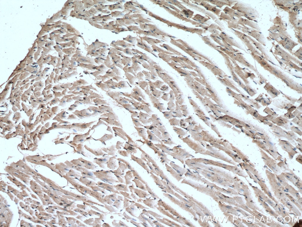 Immunohistochemistry (IHC) staining of mouse heart tissue using LRRC8C Polyclonal antibody (21601-1-AP)