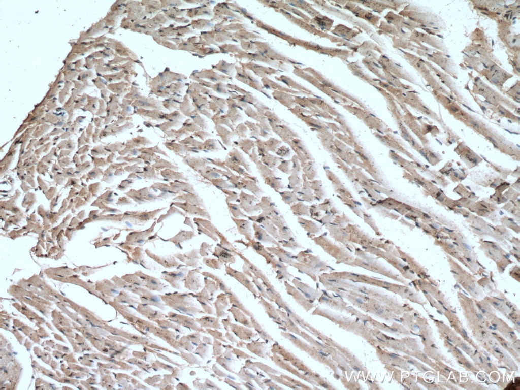 IHC staining of mouse heart using 21601-1-AP