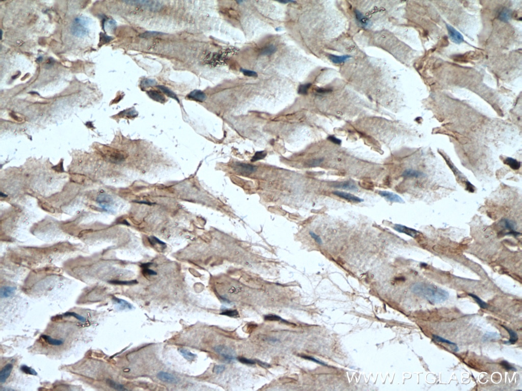 Immunohistochemistry (IHC) staining of mouse heart tissue using LRRC8C Polyclonal antibody (21601-1-AP)