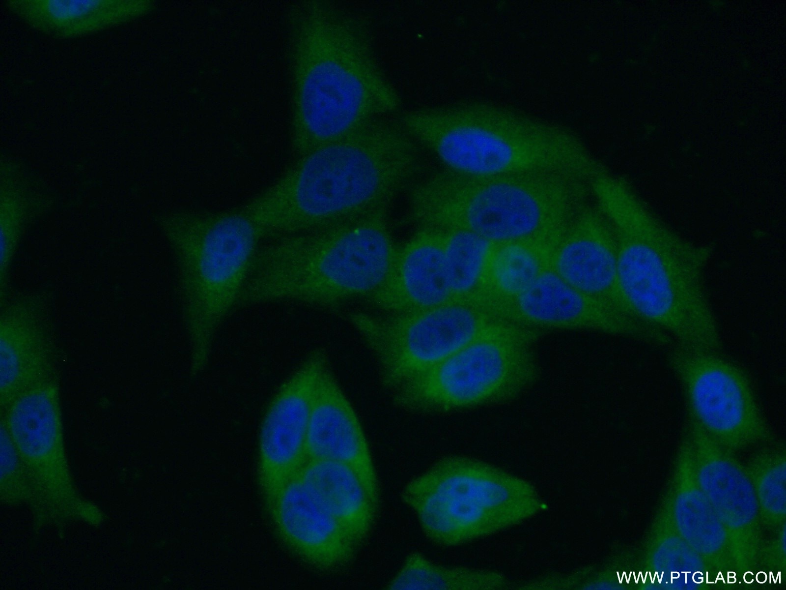 Immunofluorescence (IF) / fluorescent staining of HeLa cells using LRRC8D Polyclonal antibody (11537-1-AP)
