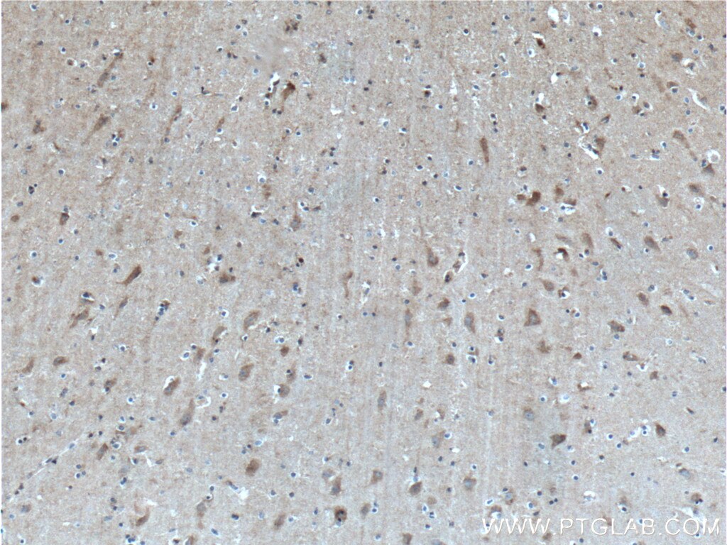Immunohistochemistry (IHC) staining of human brain tissue using LRRC8D Polyclonal antibody (11537-1-AP)