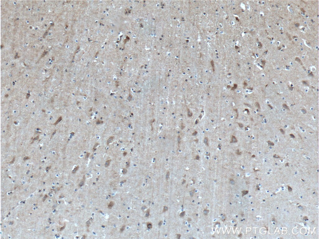 Immunohistochemistry (IHC) staining of human brain tissue using LRRC8D Polyclonal antibody (11537-1-AP)
