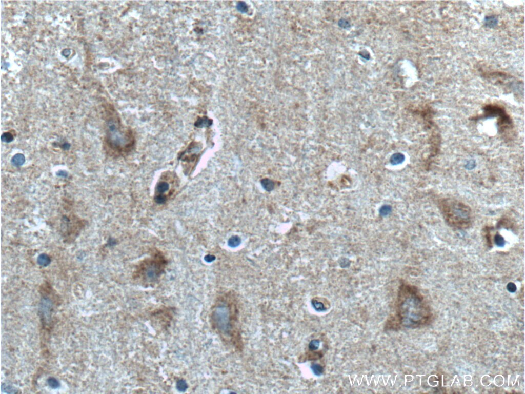 Immunohistochemistry (IHC) staining of human brain tissue using LRRC8D Polyclonal antibody (11537-1-AP)