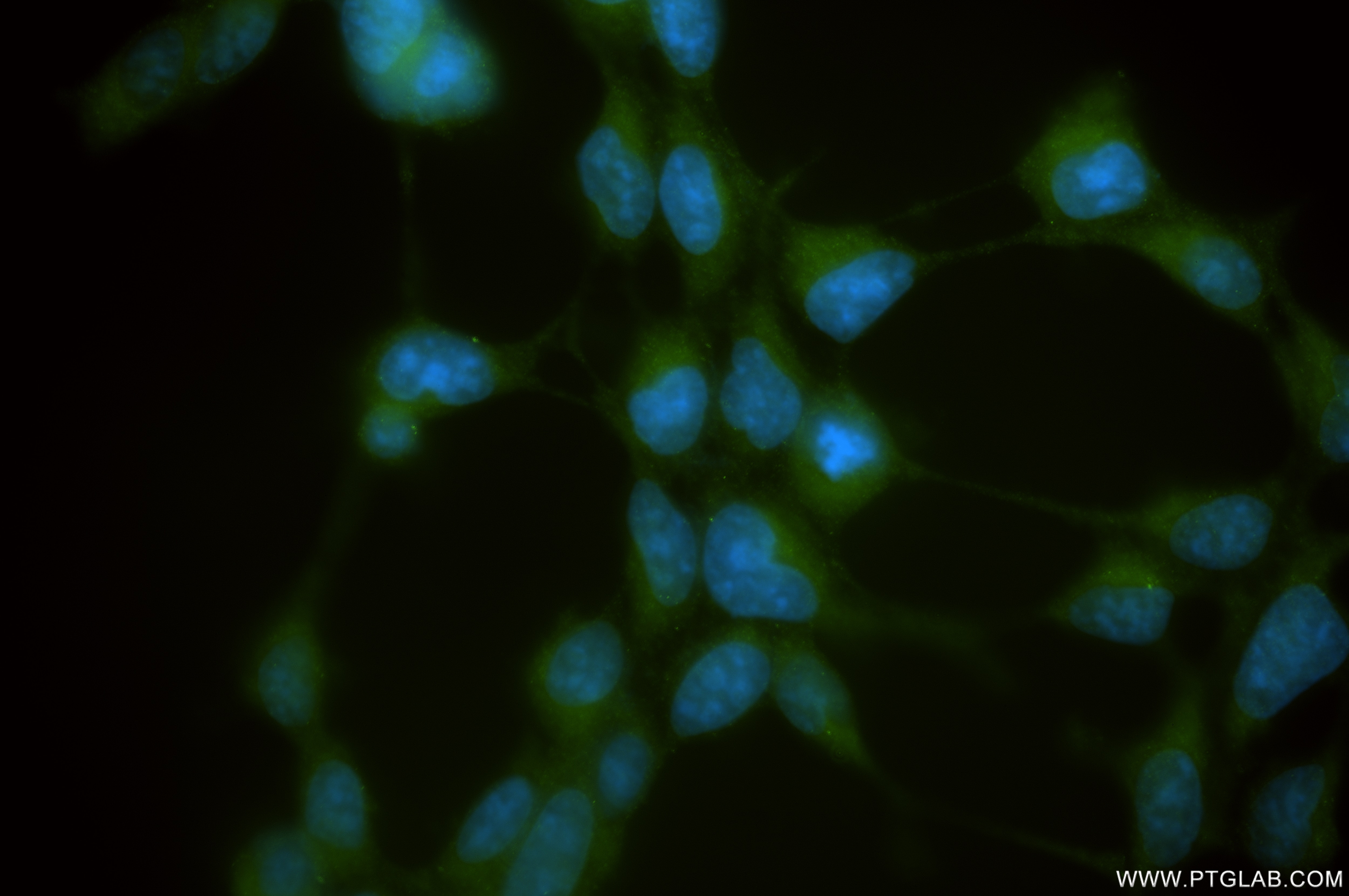 Immunofluorescent analysis of (-20°C Ethanol) fixed HEK-293 cells using LRRC8D antibody (86510-1-RR, Clone: 251257E6 ) at dilution of 1:400 and CoraLite®488-Conjugated Goat Anti-Rabbit IgG(H+L) (SA00013-2). Immunofluorescence (IF) / fluorescent staining of HEK-293 cells using LRRC8D Recombinant antibody (86510-1-RR)