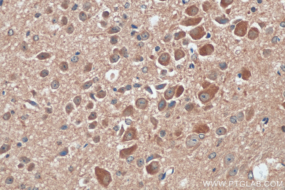 Immunohistochemistry (IHC) staining of mouse cerebellum tissue using LRRCC1 Polyclonal antibody (26317-1-AP)