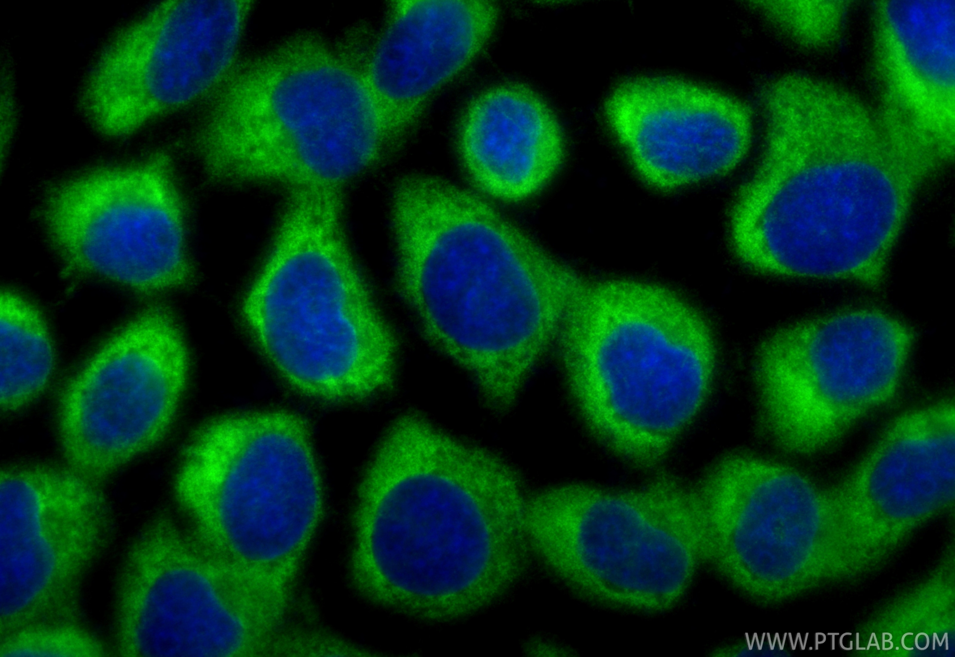 Immunofluorescent analysis of (-20°C Methanol) fixed A431 cells using LRRFIP1 antibody (84778-4-RR, Clone: 242161C9 ) at dilution of 1:500 and CoraLite®488-Conjugated Goat Anti-Rabbit IgG(H+L) (SA00013-2). Immunofluorescence (IF) / fluorescent staining of A431 cells using LRRFIP1 Recombinant antibody (84778-4-RR)
