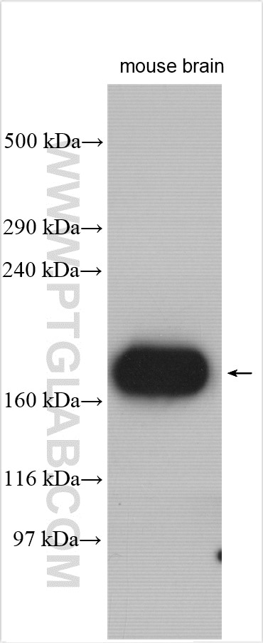 Western Blot (WB) analysis of mouse brain tissue using LRRIQ1 Polyclonal antibody (26063-1-AP)