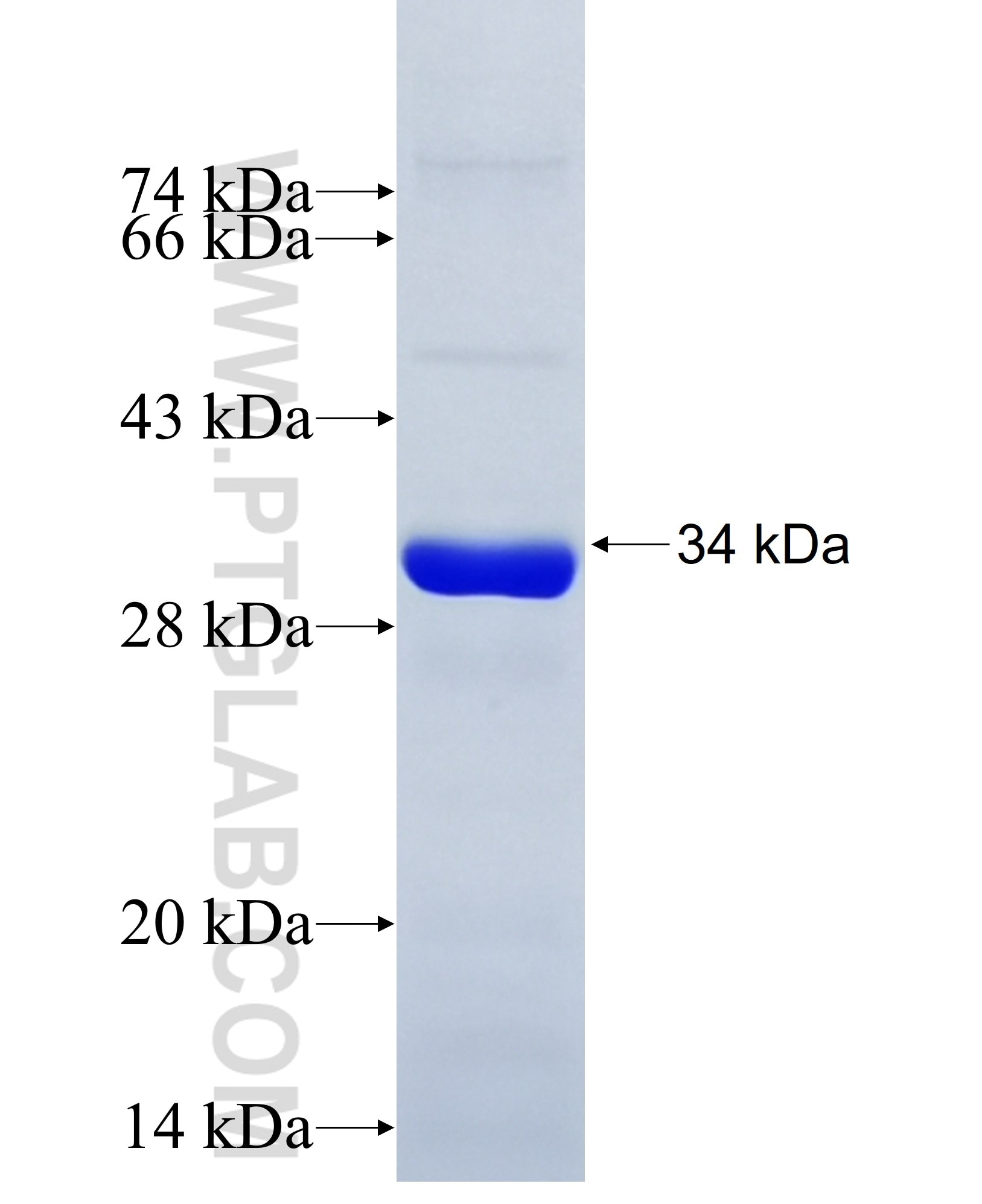 LRRK1 fusion protein Ag34939 SDS-PAGE LRRK1 fusion protein Ag34939 SDS-PAGE