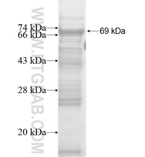 LRRK1 fusion protein Ag2599 SDS-PAGE
