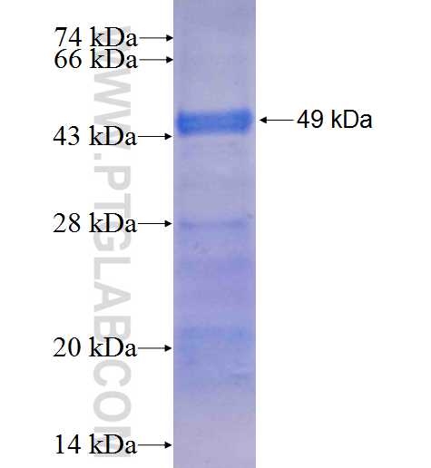 LRRK1 fusion protein Ag7786 SDS-PAGE