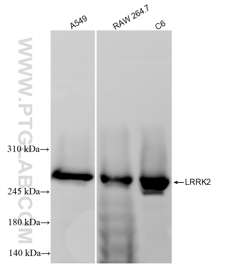 WB analysis using 84062-3-RR Western Blot (WB) analysis of various lysates using LRRK2 Recombinant monoclonal antibody (84062-3-RR)
