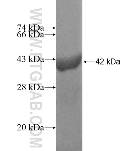 LRRN1 fusion protein Ag10626 SDS-PAGE