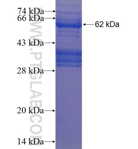 LRRN4 fusion protein Ag22866 SDS-PAGE