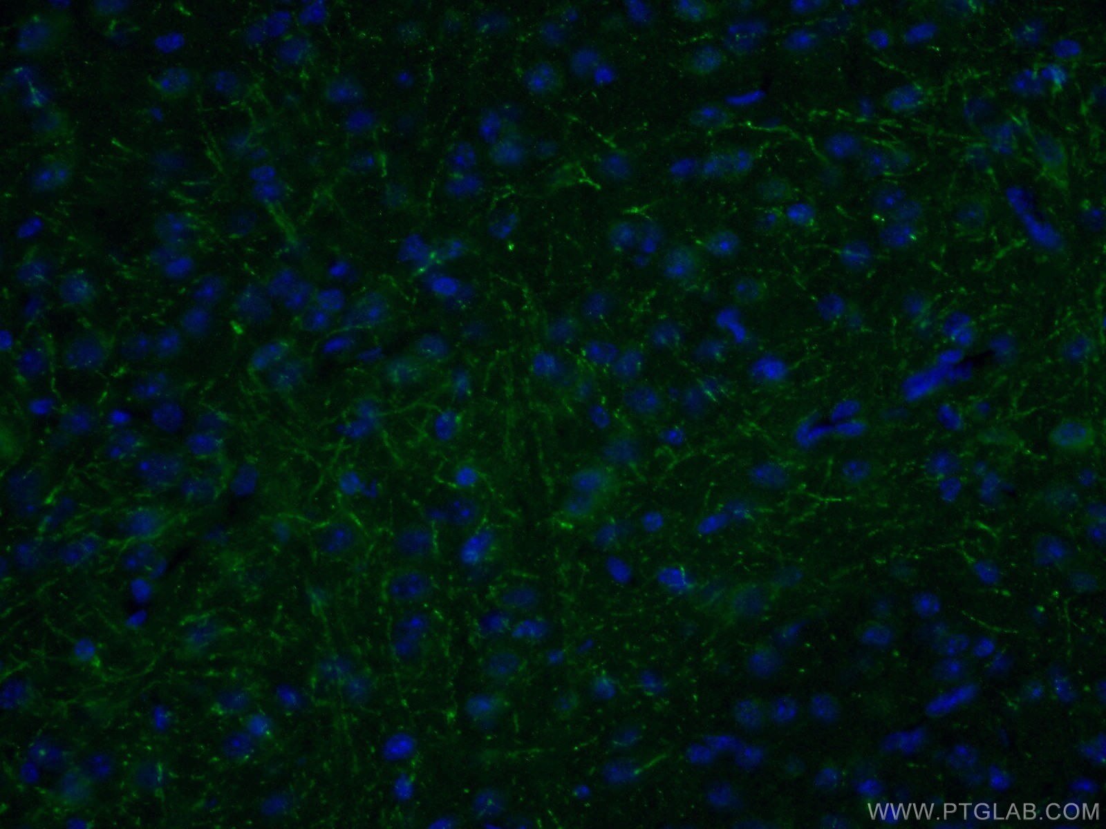 Immunofluorescence (IF) / fluorescent staining of mouse brain tissue using LRRTM1 Polyclonal antibody (14288-1-AP)