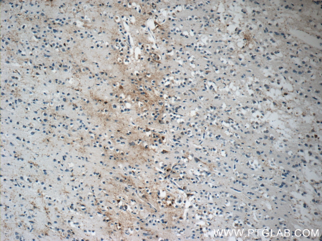 Immunohistochemistry (IHC) staining of human brain tissue using LRRTM1 Polyclonal antibody (14288-1-AP)