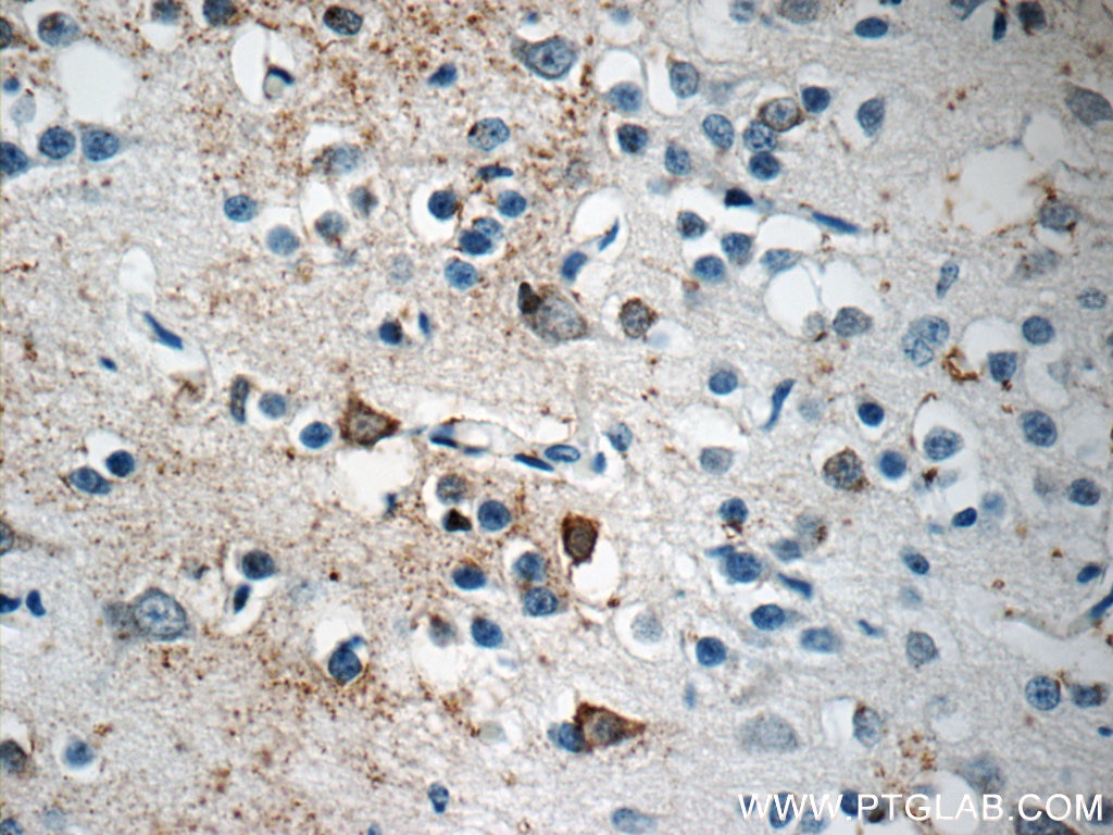 Immunohistochemistry (IHC) staining of human brain tissue using LRRTM1 Polyclonal antibody (14288-1-AP)