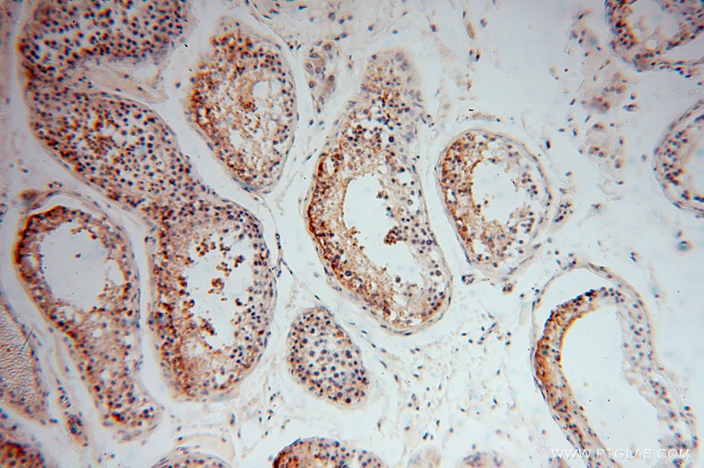 IHC staining of human testis using 14288-1-AP