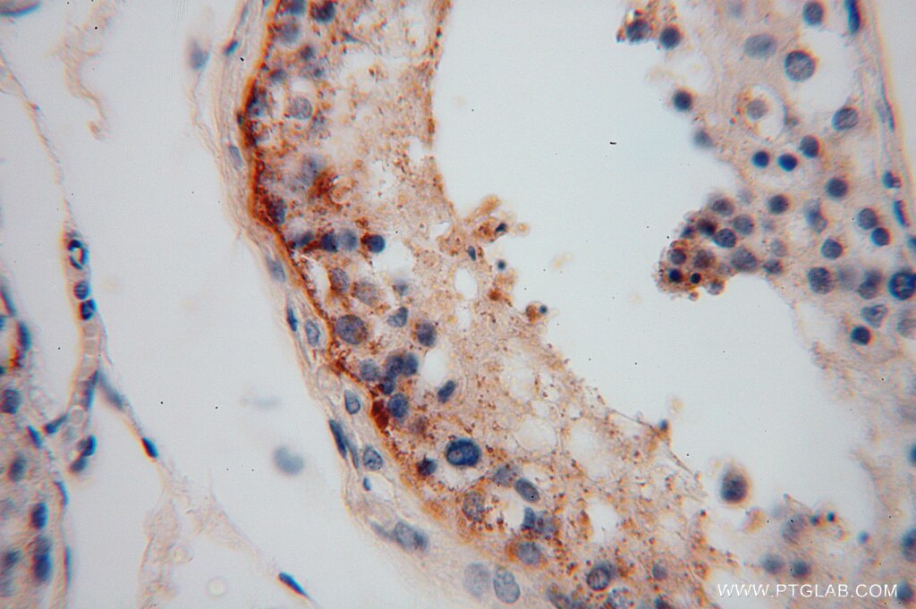 Immunohistochemistry (IHC) staining of human testis tissue using LRRTM1 Polyclonal antibody (14288-1-AP)