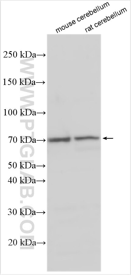 Western Blot (WB) analysis of various lysates using LRRTM1 Polyclonal antibody (14288-1-AP)