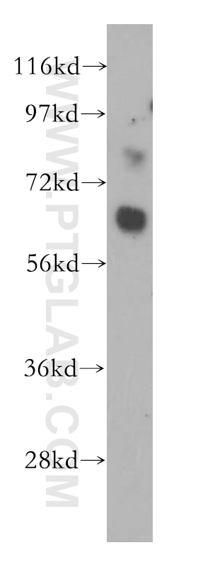Western Blot (WB) analysis of HEK-293 cells using LRRTM1 Polyclonal antibody (14288-1-AP)