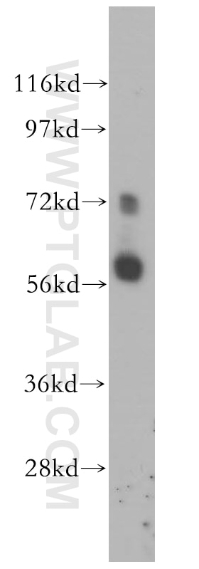 Western Blot (WB) analysis of HeLa cells using LRRTM1 Polyclonal antibody (14288-1-AP)