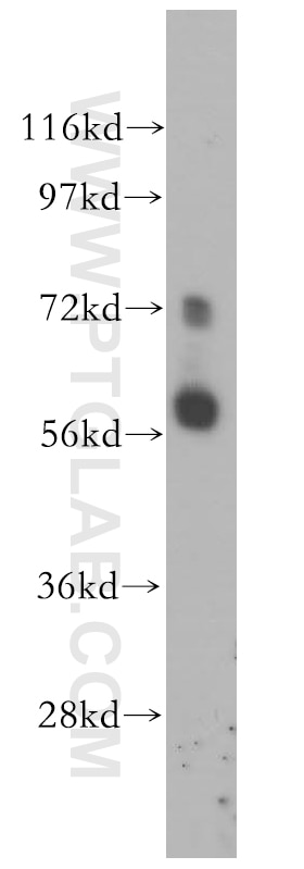 WB analysis of HeLa using 14288-1-AP