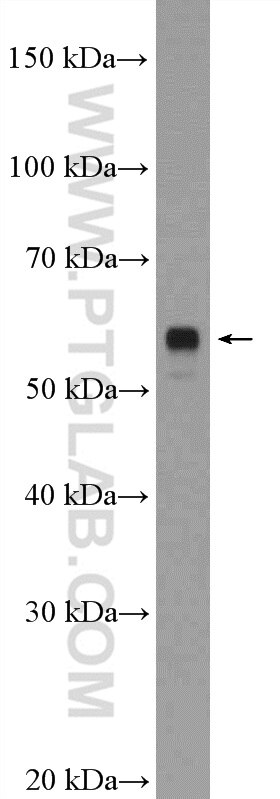 Western Blot (WB) analysis of mouse spinal cord tissue using LRRTM2 Polyclonal antibody (23094-1-AP)