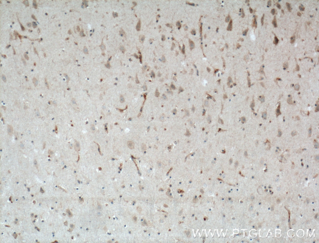 Immunohistochemistry (IHC) staining of human brain tissue using LRRTM3 Polyclonal antibody (27003-1-AP)